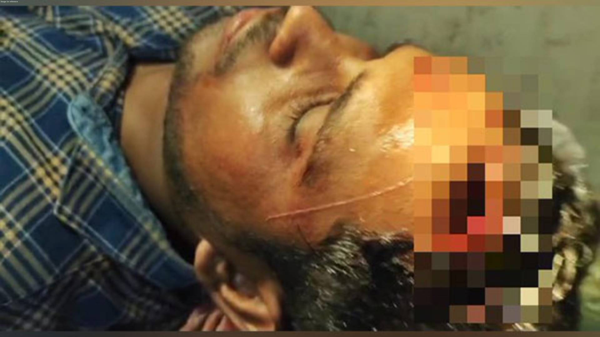 Lok Sabha polls: ANI stringer Bunty Mukherjee severely injured in TMC-BJP clashes in West Bengal